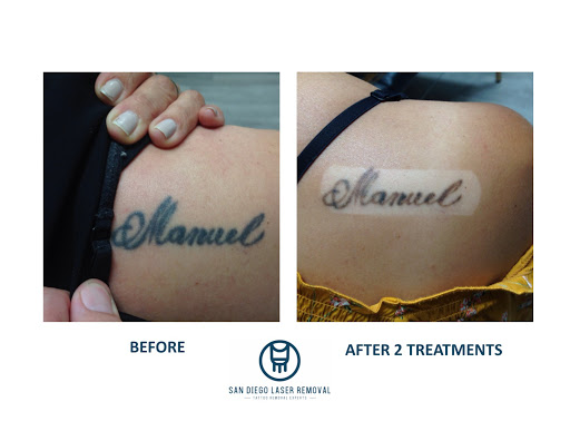 Explore leg sleeve tattoo ideas for women, creative tattoo ideas in San Diego, available at Removery Tattoo Removal & Fading