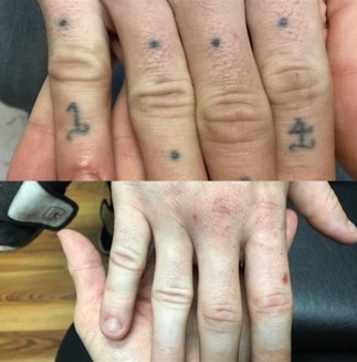 Explore tattoo ideas for autism, creative tattoo ideas in Lawton, available at Clean Canvas Tattoo Removal