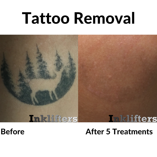 Explore statue tattoo ideas, creative tattoo ideas in Pleasant Grove, available at Inklifters Tattoo Removal