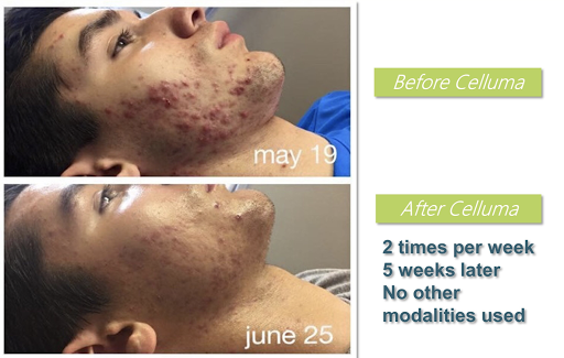 Day Spa «La Estetica Wellness Spa», reviews and photos, 424 N San Mateo Dr #500, San Mateo, CA 94401, USA