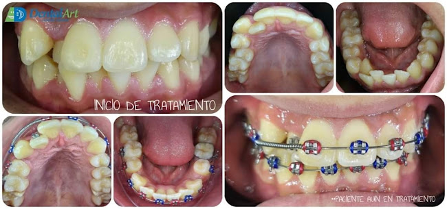 Opiniones de Clinica Dental Art en Osorno - Dentista
