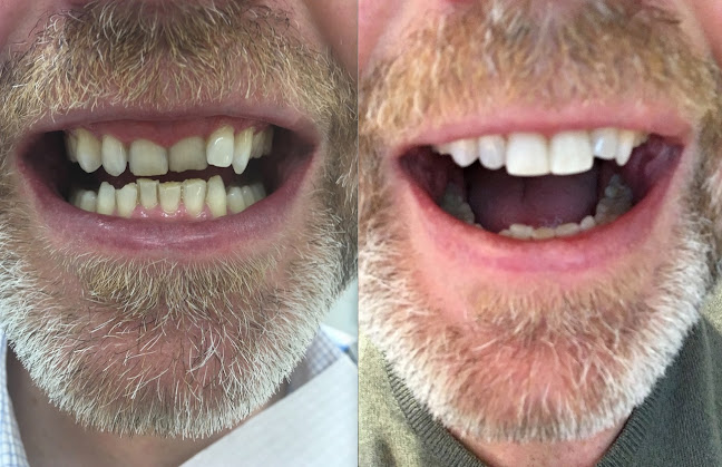 Reviews of Prospect Street Dental Practice - Reading Dentists in Reading - Dentist