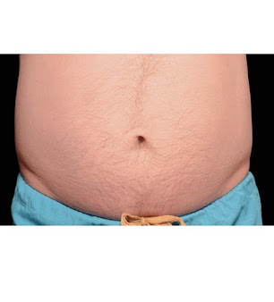 Bucks Cavitation - Bucks Cavitation