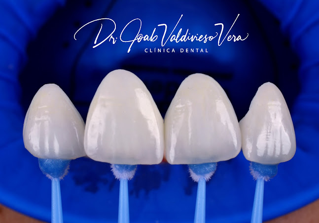 Comentarios y opiniones de Estética Dental Manta - Dr. Joab Valdivieso Vera / Odontólogo