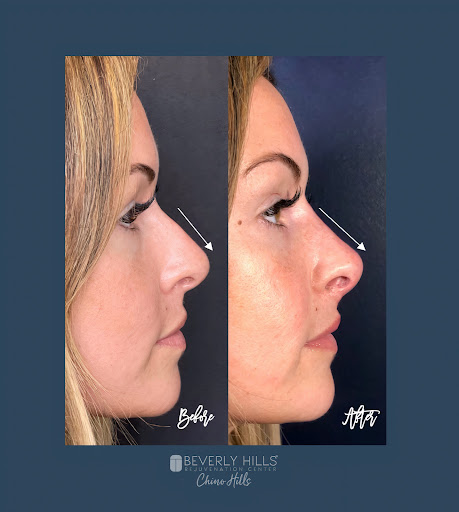 Beverly Hills Rejuvenation Center image