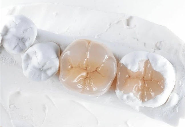 Opinii despre ΟΔΟΝΤΟΤΕΧΝΙΚΟ Εργαστήριο Ψηφιακής τεχνολογίας Γιώργος Σέγκος în Νέα Ιωνία - Εργαστήριο