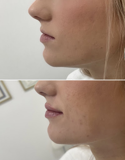 Explore depression tattoo ideas, creative tattoo ideas in Owensboro, available at The Skin Lab