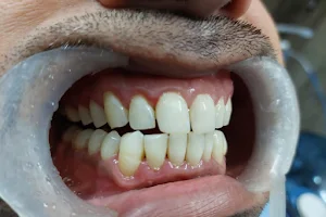 Sri Sai Dental Care ( Multi Specialist Dental Clinic) image