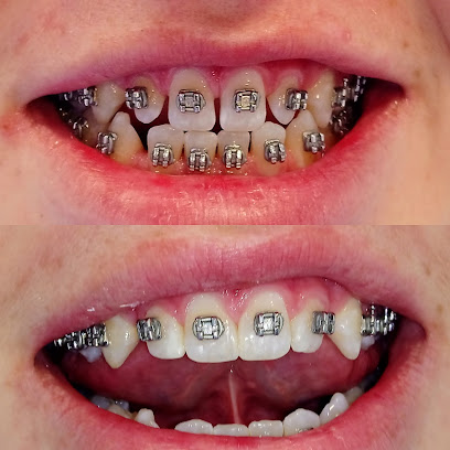 Clínica dental de Rehabilitación Oral - Implantología - Urgencia Dental- Estética dental - Carillas de porcelana