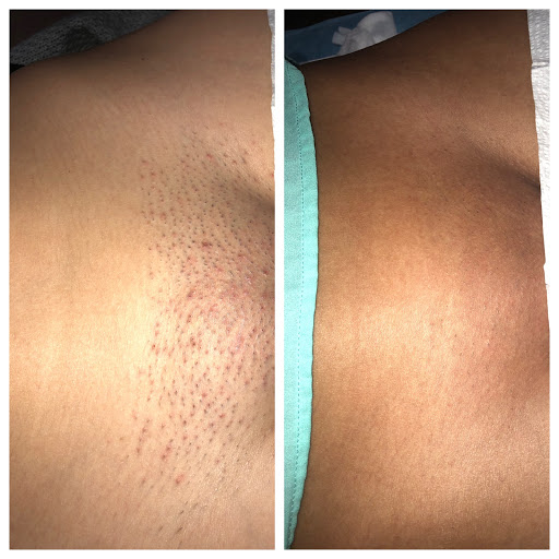 Explore egyptian hand tattoo ideas, creative tattoo ideas in Raleigh, available at ExcelLase