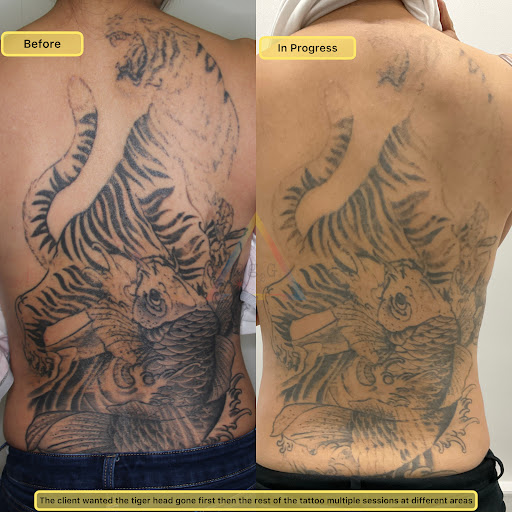 Explore dragon ball z tattoo ideas, creative tattoo ideas in New York, available at Ag2g Laser Tattoo Removal & MedSpa