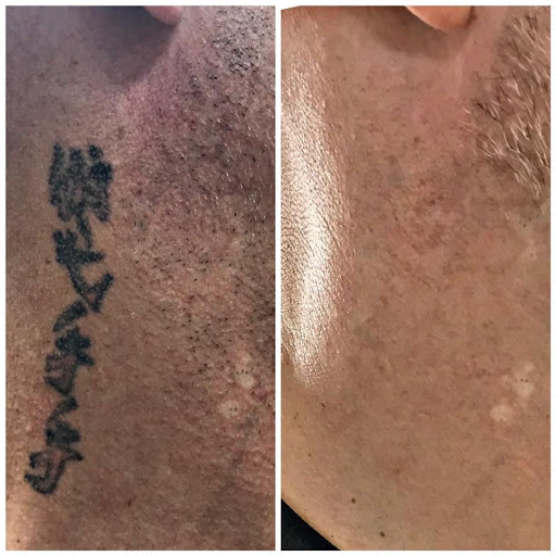 Explore cycle tattoo ideas, creative tattoo ideas in Pinellas Park, available at St Pete Tattoo Removal