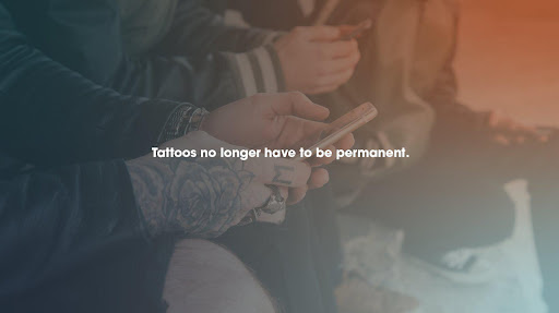 Removery Tattoo Removal & Fading