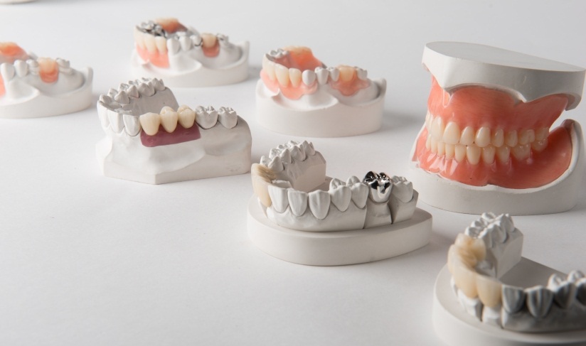 DENT POUR DENT Laboratoire de prothèses dentaires à Chennevières-sur-Marne (Val-de-Marne 94)