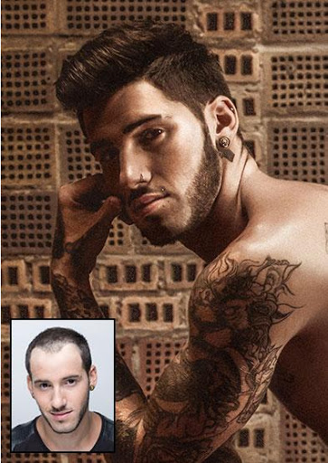 Hair Replacement Service «Elite Solutions Hair Loss Specialists of Sacramento», reviews and photos, 9294 Madison Ave, Orangevale, CA 95662, USA