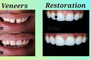 Perfect Dental Clinic, Dr Narayan Raut- Best Dental Clinic in Siolim for RCT, Braces, Implants, Aligners &More image
