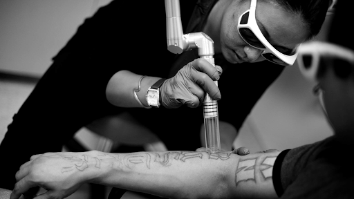 Explore side head tattoo ideas, creative tattoo ideas in San Jose, available at New Skin Tattoo Removal