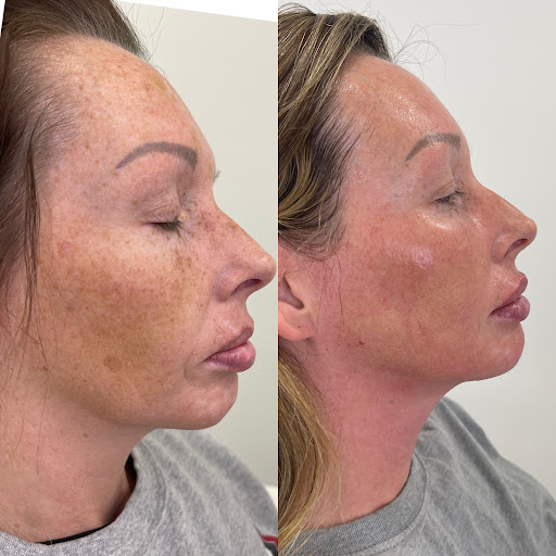 Find tattoo ideas for in between breast for your next unique tattoo in Owensboro at The Skin Lab