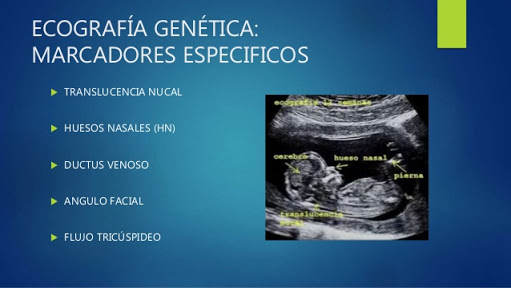 Opiniones de Centro Médico de diagnóstico por imágenes Maria Belen en Pacasmayo - Médico