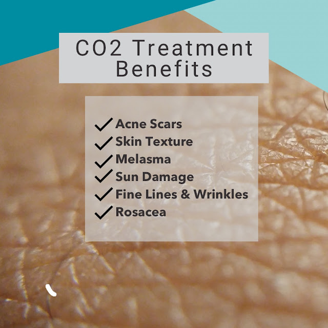 Aspire Medical Spa - Arvada