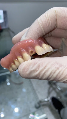 Laboratoire de prothèse dentaire à La Courneuve