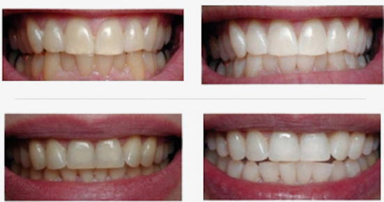 White Smile Dental - Limerick City - White Smile Dental - Limerick City