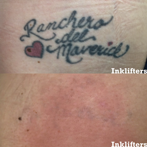 Explore tattoo ideas aztec, creative tattoo ideas in Pleasant Grove, available at Inklifters Tattoo Removal