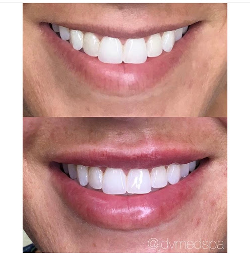 Explore small chest tattoo ideas for guys, creative tattoo ideas in Canton, available at JDV Med Spa