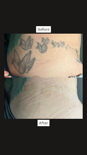 Explore bandana tattoo ideas, creative tattoo ideas in San Antonio, available at San Antonio Tattoo Removal Co.