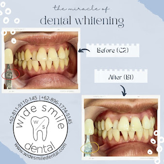 Wide Smile Dental Clinic - Wide Smile Dental Clinic