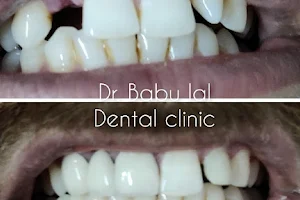 dr. babu lal dental & Facial cosmetic surgery clinic image