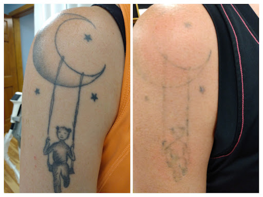 Explore small egyptian tattoo ideas, creative tattoo ideas in Glenwood Springs, available at Lifestyle Laser