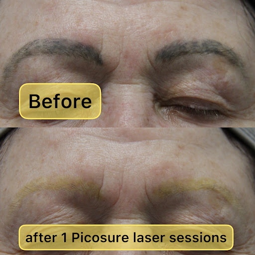 Find cool skull tattoo ideas for your next unique tattoo in New York at Ag2g Laser Tattoo Removal & MedSpa