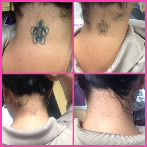 Explore japanese chest tattoo ideas, creative tattoo ideas in Honolulu, available at Way Gone Laser Tattoo Removal