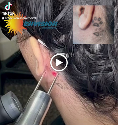 Explore nipple tattoo ideas, creative tattoo ideas in Port Charlotte, available at Envision Laser Removal