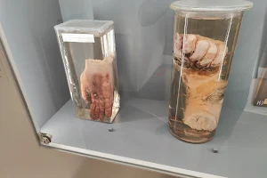 Narrenturm - Pathologisch-anatomische Sammlung image