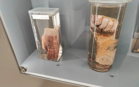 Narrenturm - Pathologisch-anatomische Sammlung image