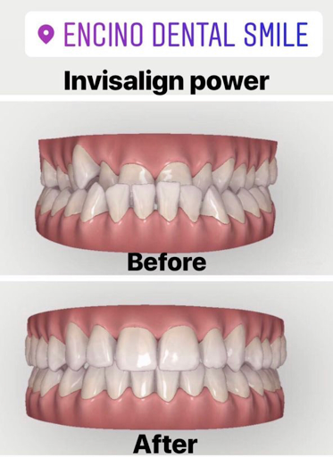 Encino Dental Smile image
