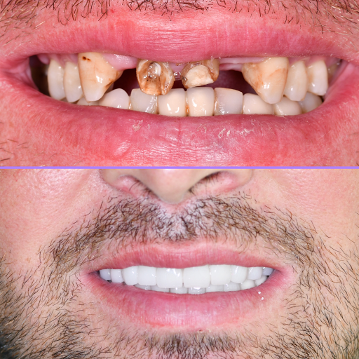 Özel IDH Süleyman Mert Ağız ve Diş Sağlığı Merkezi - Antalya Diş Hekimi - Antalya Dentist