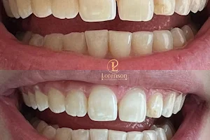Dentista Dra Priscila Lorenson Osasco SP, Rinomodelação, Aparelho Invisalign, Limpeza e Clareamento Dental, Prótese image