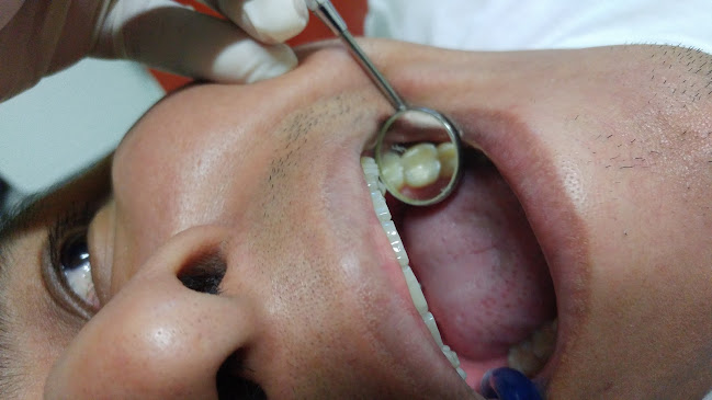 Medic Dent - Dr. Hugo B. Ayauja H. - Dentista