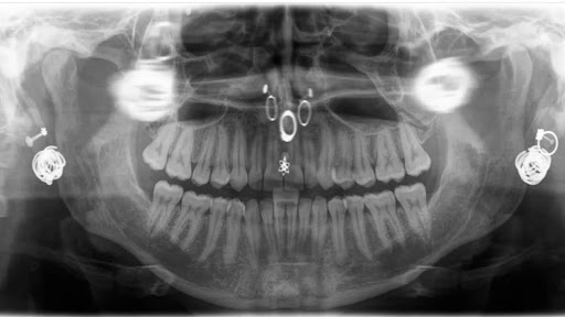 Explore bass clef tattoo ideas, creative tattoo ideas in Memphis, available at Rose Quartz Body Adornment LLC