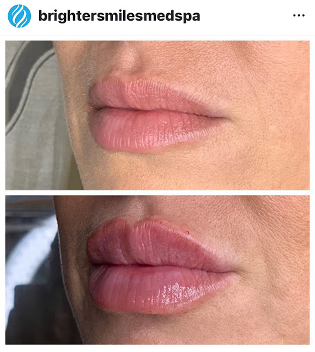 Explore dnr tattoo ideas, creative tattoo ideas in Eugene, available at Brighter Smiles Med Spa and Laser Center