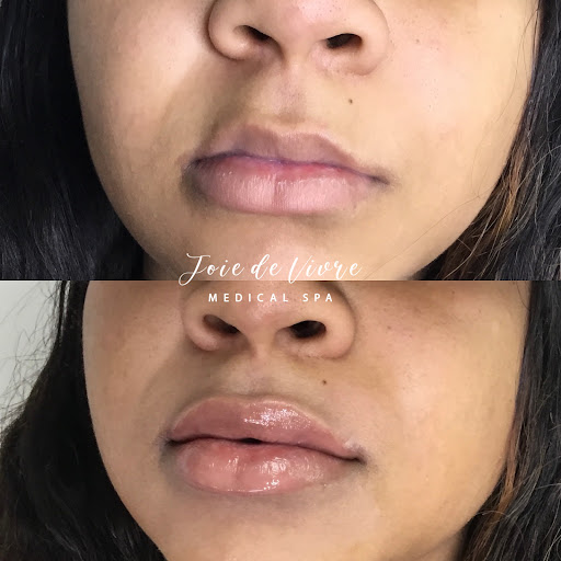 Explore grandchildren tattoo ideas, creative tattoo ideas in Canton, available at JDV Med Spa