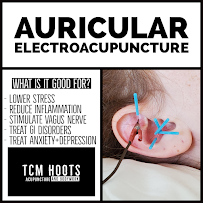 Hoots Acupuncture PLLC - Photo 7 - Car repair in Brooklyn, NY, New York