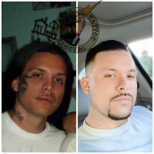 Explore womens leg sleeve tattoo ideas, creative tattoo ideas in Reno, available at Reno Tattoo Removal