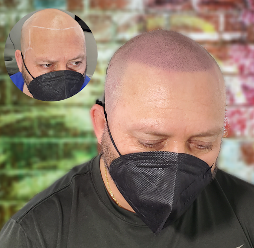 Downey Hair Loss Solutions SMP image
