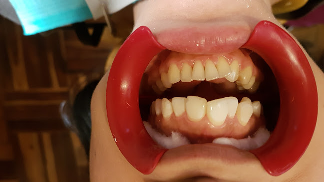 Opiniones de Añorga Dental en Víctor Larco Herrera - Dentista