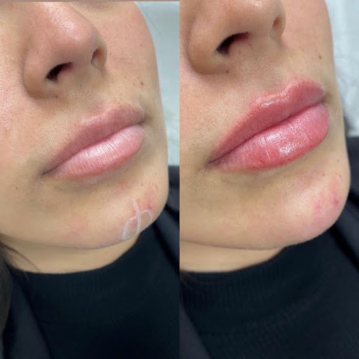 Explore coordinates tattoo ideas, creative tattoo ideas in Whittier, available at Skin Perfect Medical Aesthetics