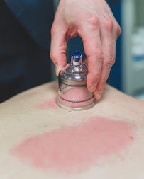 Mandarino Acupuncture Brooklyn NY - Photo 3 - Car repair in Brooklyn, NY, Staten Island